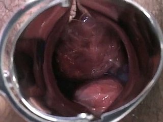 Pregnant Japanese lady is examined and sucks doctor's lollicock