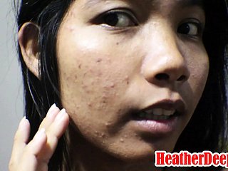 9 Wochen schwanger thailändischer asiatischer Teen