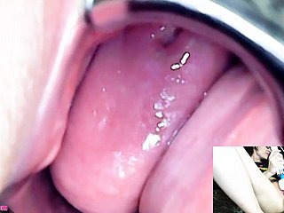 Adalynnx - Endoscope Speculum Vibrator Hitachi Cum