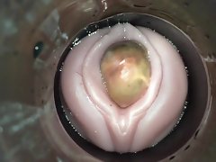 undexterous ovulation apart from cum cam baffle